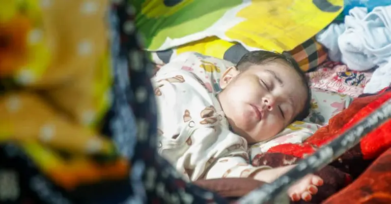 হামে আক্রান্ত এক শিশু